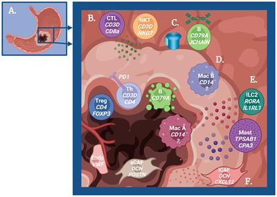 Discovering Immune-Mediated Mechanisms of Gastric Carcinogenesis Through Single-Cell RNA Sequencing